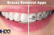 Best 05 Braces Removal Apps for Android & iOS