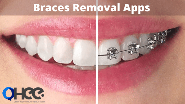 Braces Removal Apps